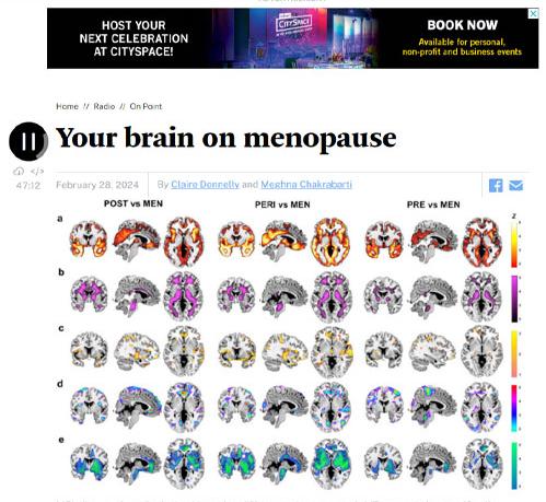 Your Brain on Menopause. WBUR 